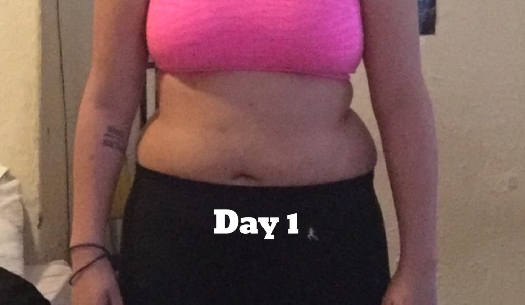 weight loss results - before photo